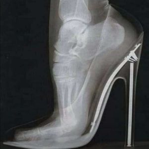 Meet your Posher, El aider